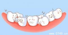 牙齿畸形矫正需要多少钱 受很多因素决定